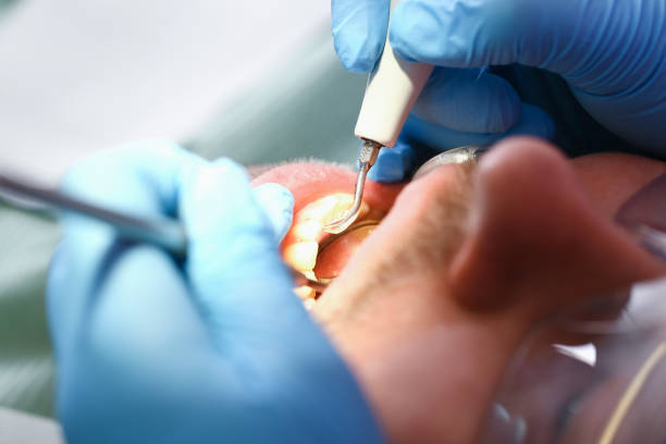 Best Emergency Treatment for Toothache in Squaw Valley, CA